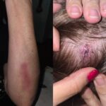 Violento conflicto por tierras: familia denuncia agresiones de las hermanas Lindstron